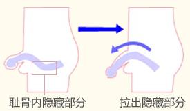 男性阴茎短小的原因是什么