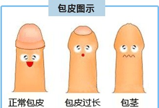 你知道包皮过长和包茎的区别吗？